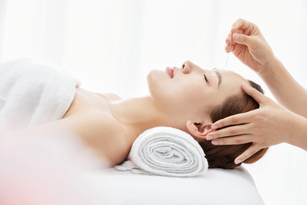châm cứu tại nhà