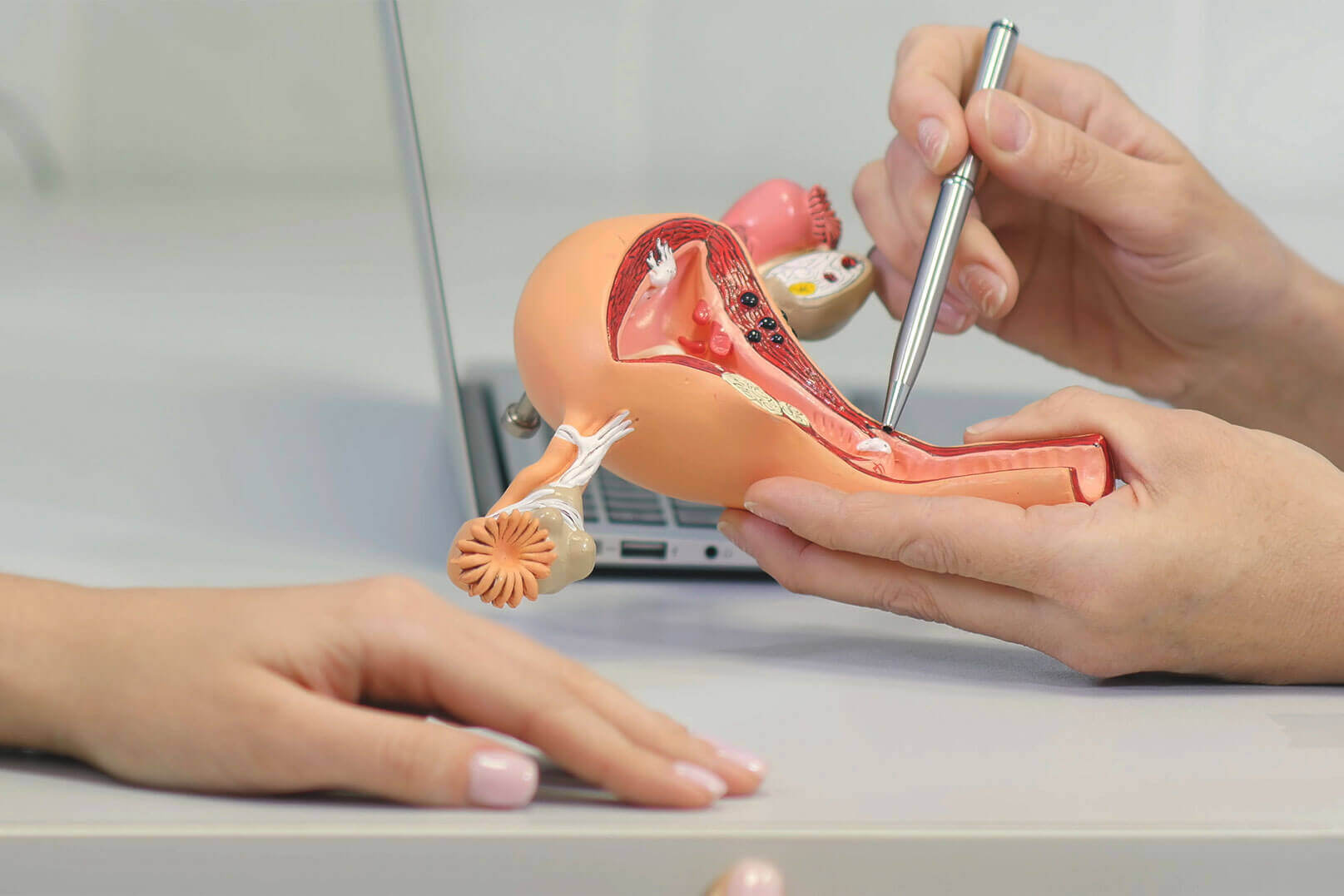 thắt ống dẫn trứng là gì thắt ống dẫn trứng là gì
