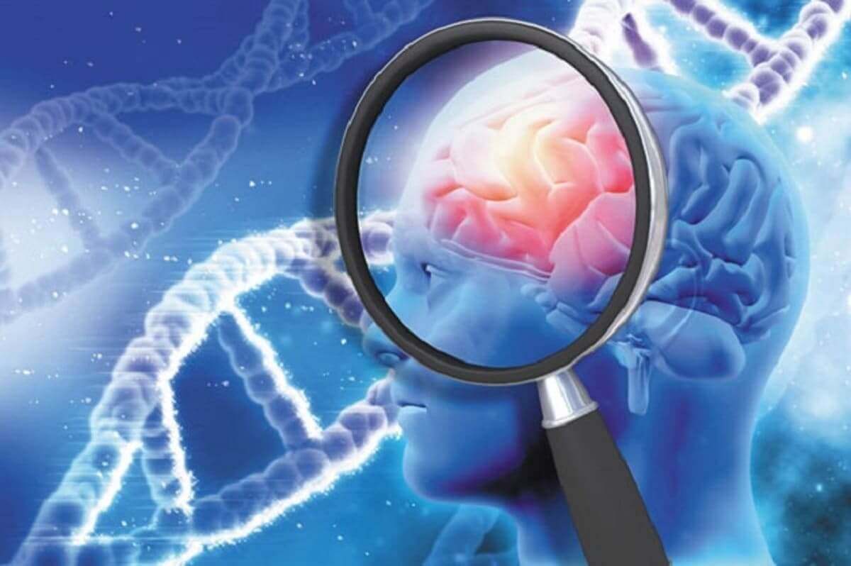 bệnh alzheimer sống được bao lâu