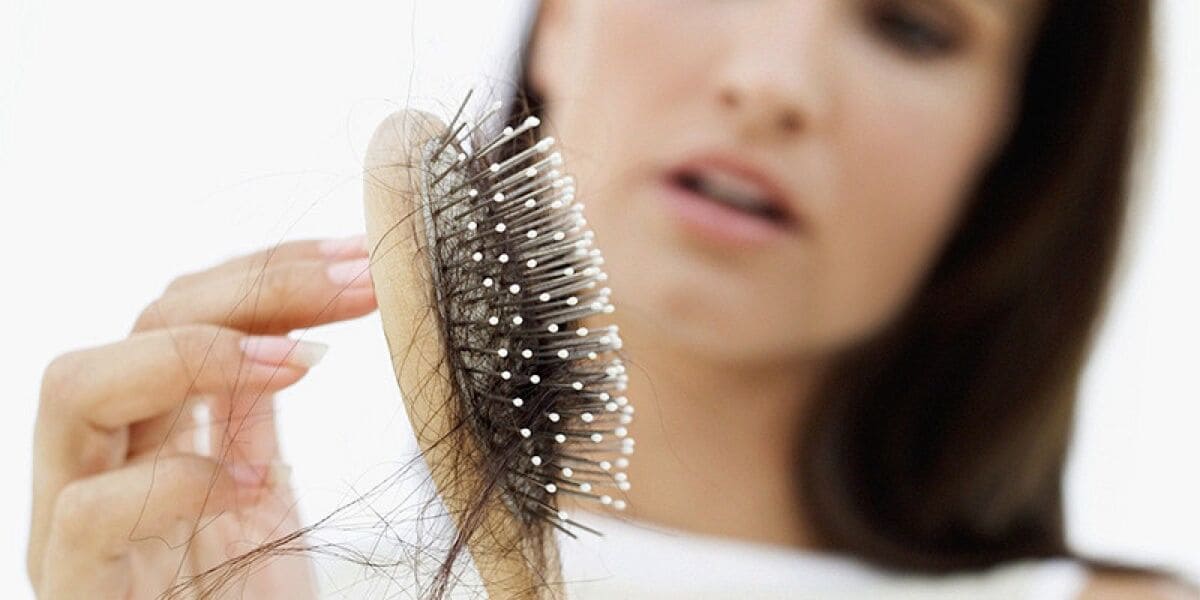 bị rụng tóc nhiều ở nữ bị rụng tóc nhiều ở nữ