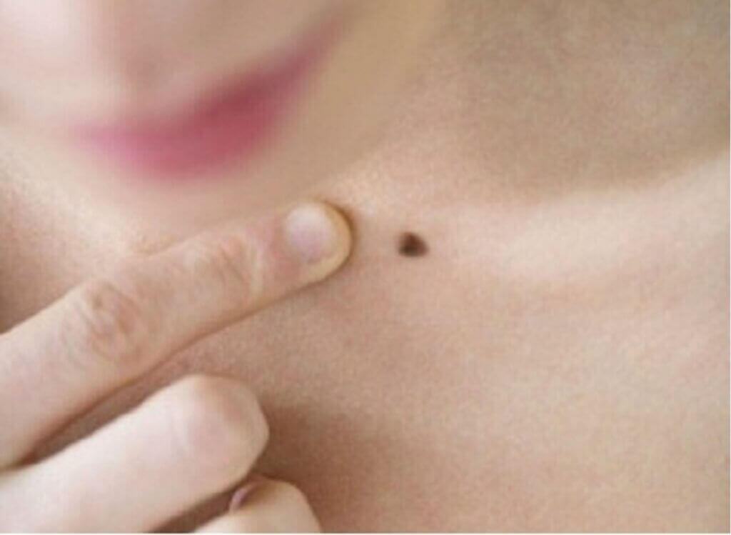 vị trí nốt ruồi giàu sang phú quý