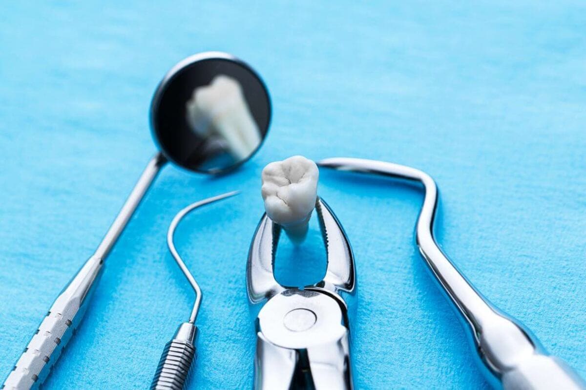 nhổ răng khôn để trị đau nướu răng nhổ răng khôn để trị đau nướu răng