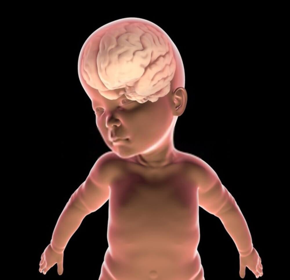 Não úng thủy trẻ sơ sinh