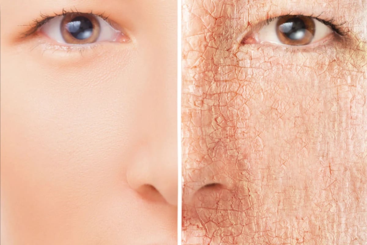 Retinol có dùng cho phụ nữ cho con bú