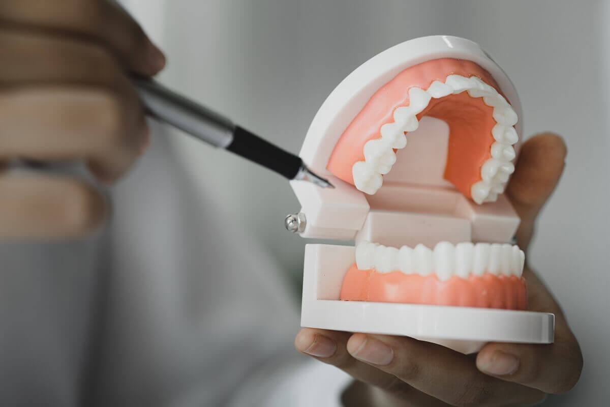 Khắc phục răng bị đen do mão răng sứ Khắc phục răng bị đen do mão răng sứ