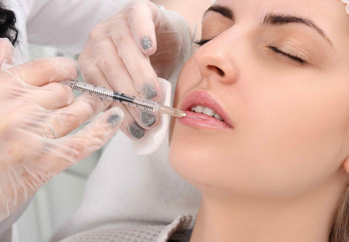 tiêm filler có hại về sau không tiêm filler có hại về sau không