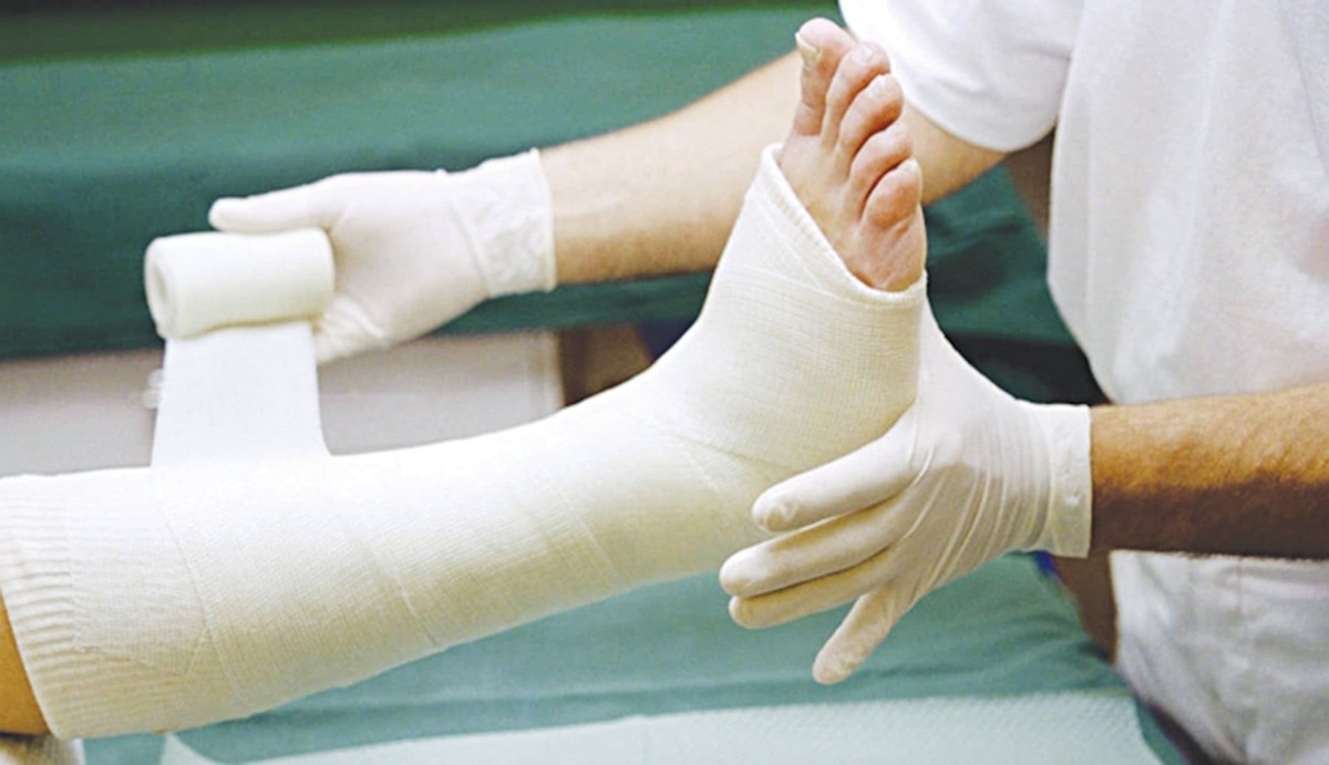 cách điều trị bệnh loãng xương cách điều trị bệnh loãng xương