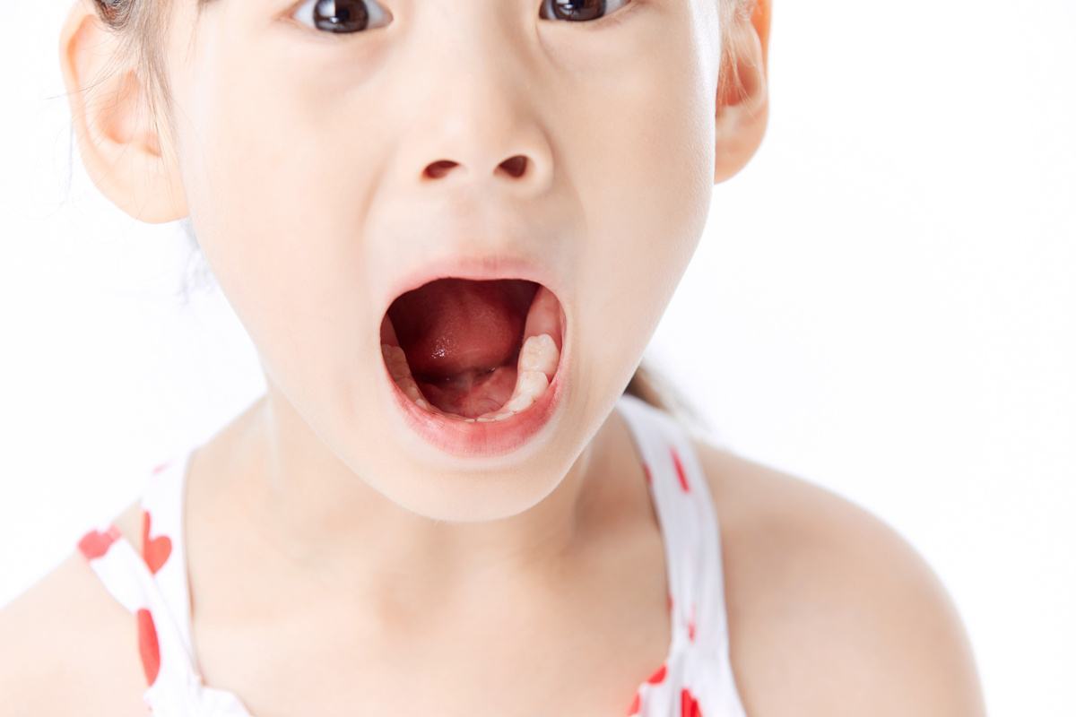 Trẻ em bị hôi miệng là bệnh gì trẻ em bị hôi miệng là bệnh gì
