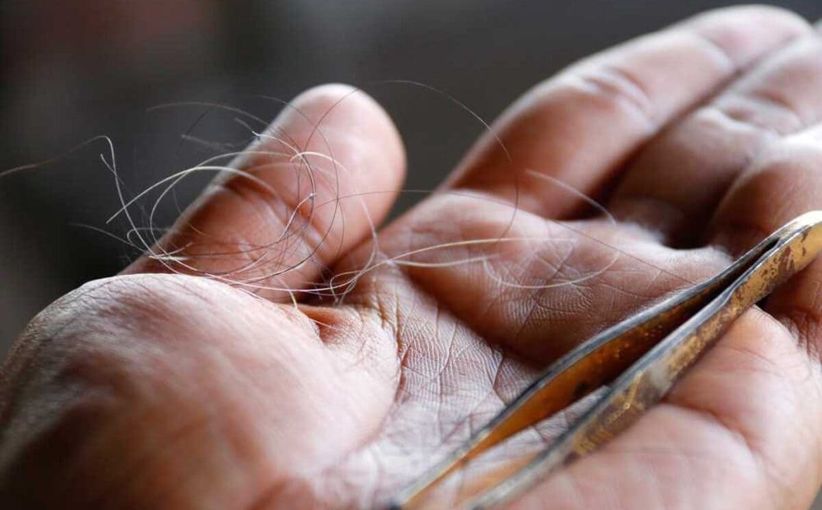 Trẻ em có tóc bạc trẻ em có tóc bạc