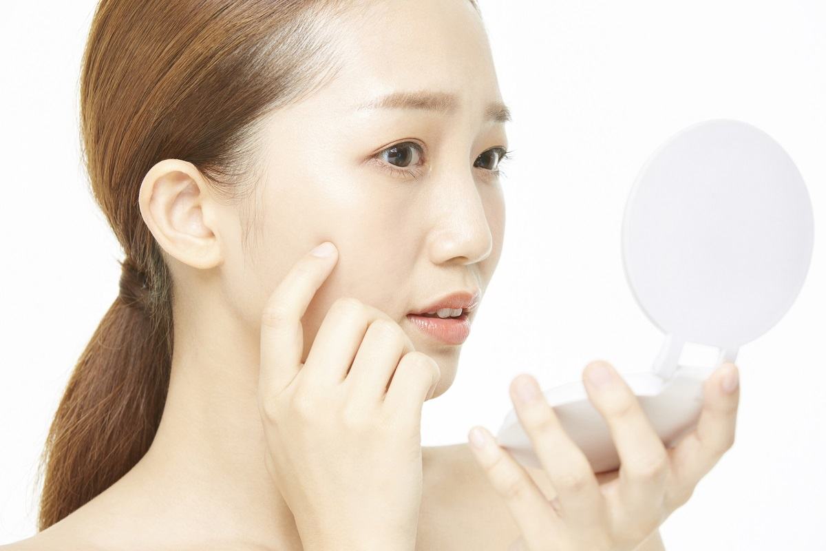 trị sẹo thâm sau thủy đậu trị sẹo thâm sau thủy đậu