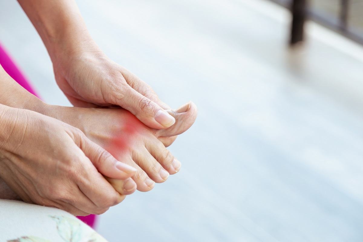 Dấu hiệu của bệnh Gout Dấu hiệu của bệnh Gout