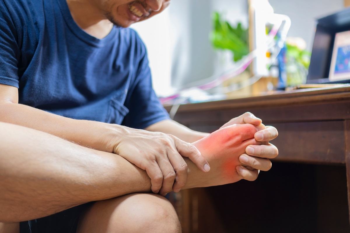 Nguyên nhân bệnh gout là gì Nguyên nhân bệnh gout là gì