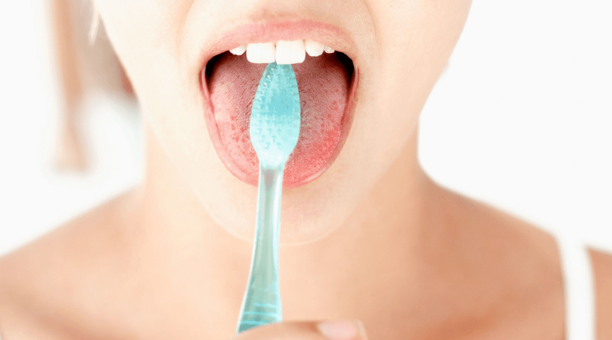 cách vệ sinh lưỡi bị trắng