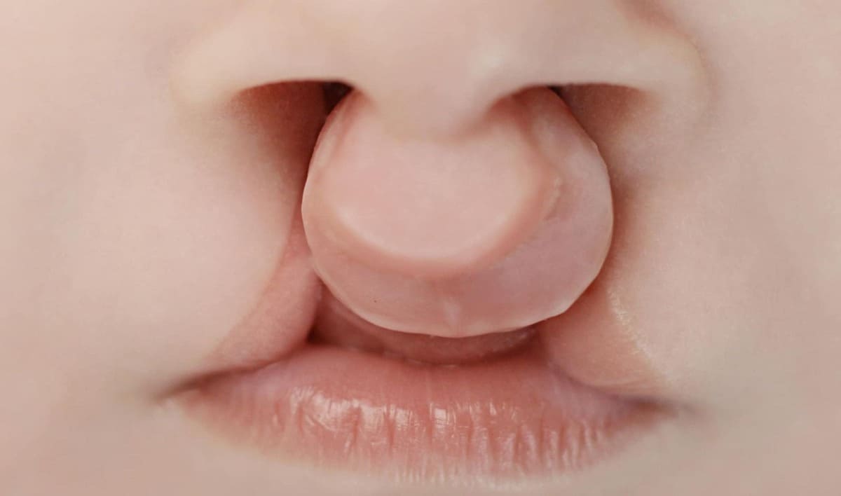 hậu quả của hôn nhân cận huyết thống hậu quả của hôn nhân cận huyết thống