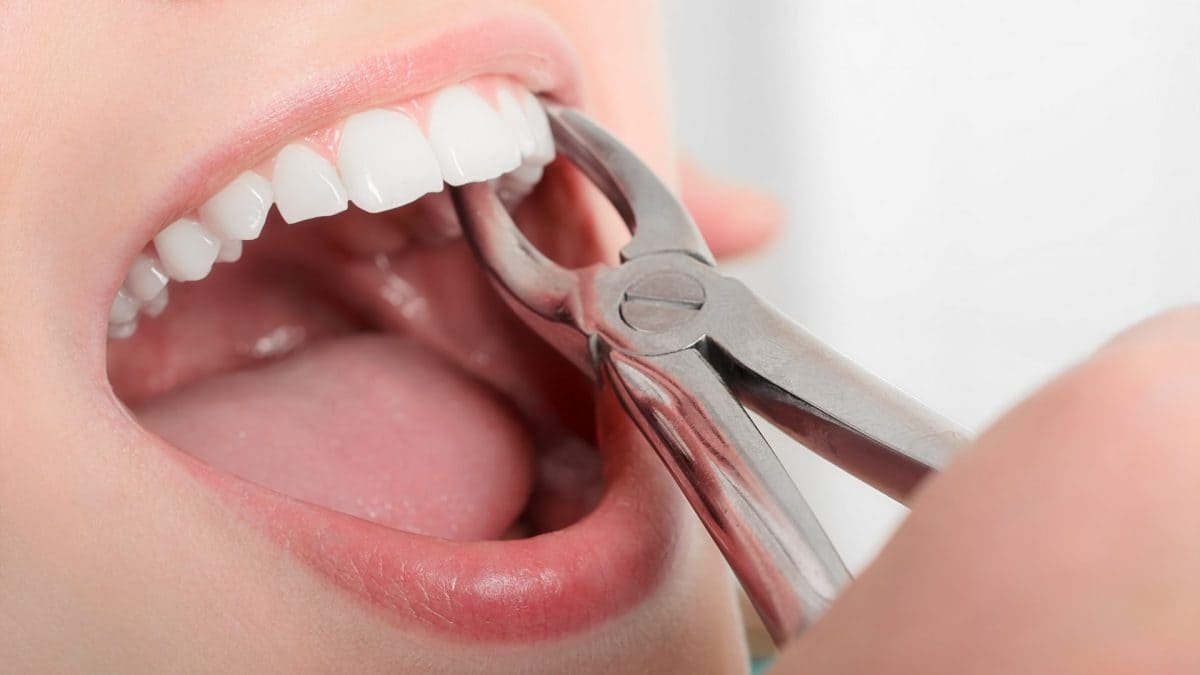 giấc mơ thấy rụng răng giấc mơ thấy rụng răng