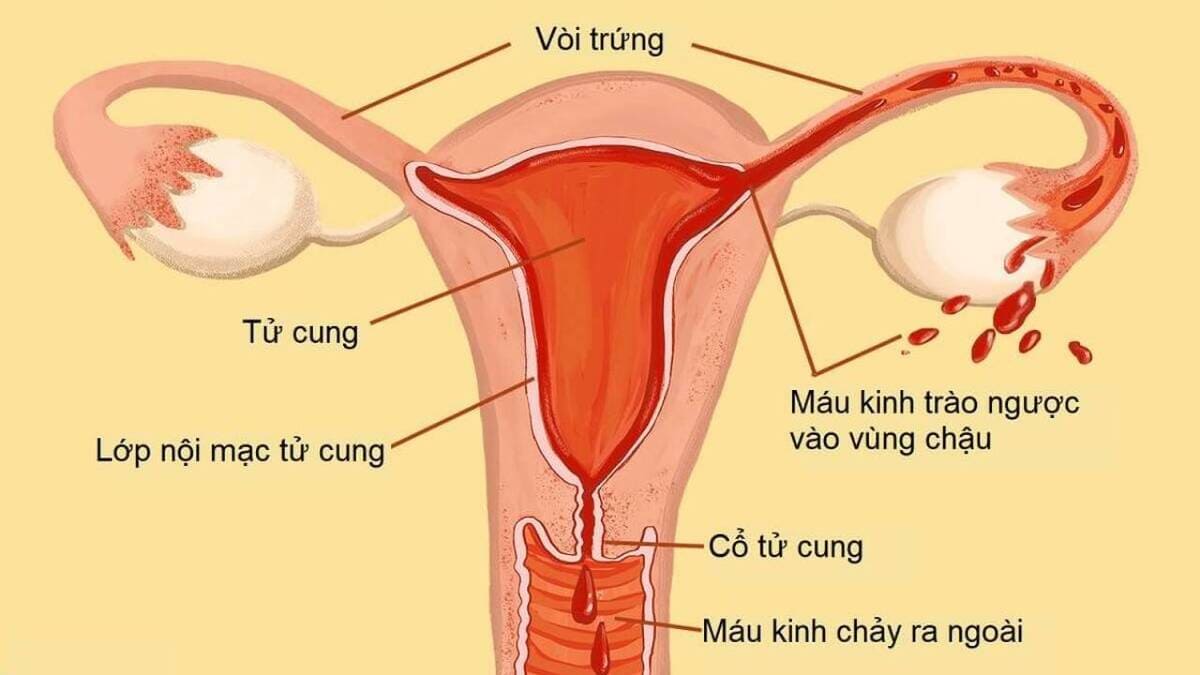tử cung niêm mạc tử cung là gì