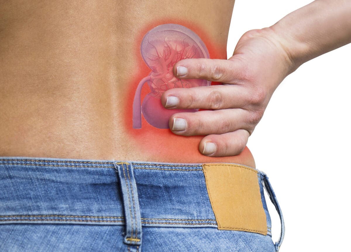 bệnh sỏi thận có nguy hiểm không 