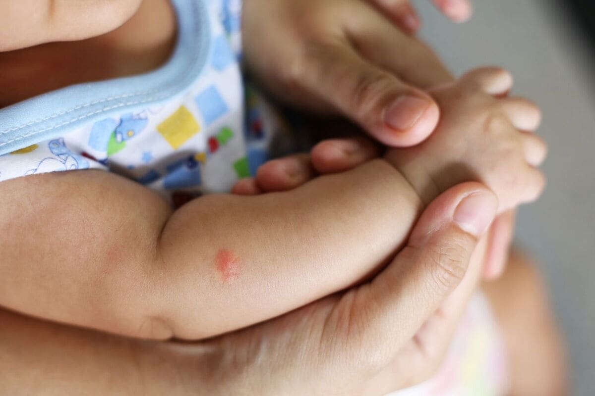 Dấu hiệu nhận biết trẻ sơ sinh bị muỗi đốt Dấu hiệu nhận biết trẻ sơ sinh bị muỗi đốt