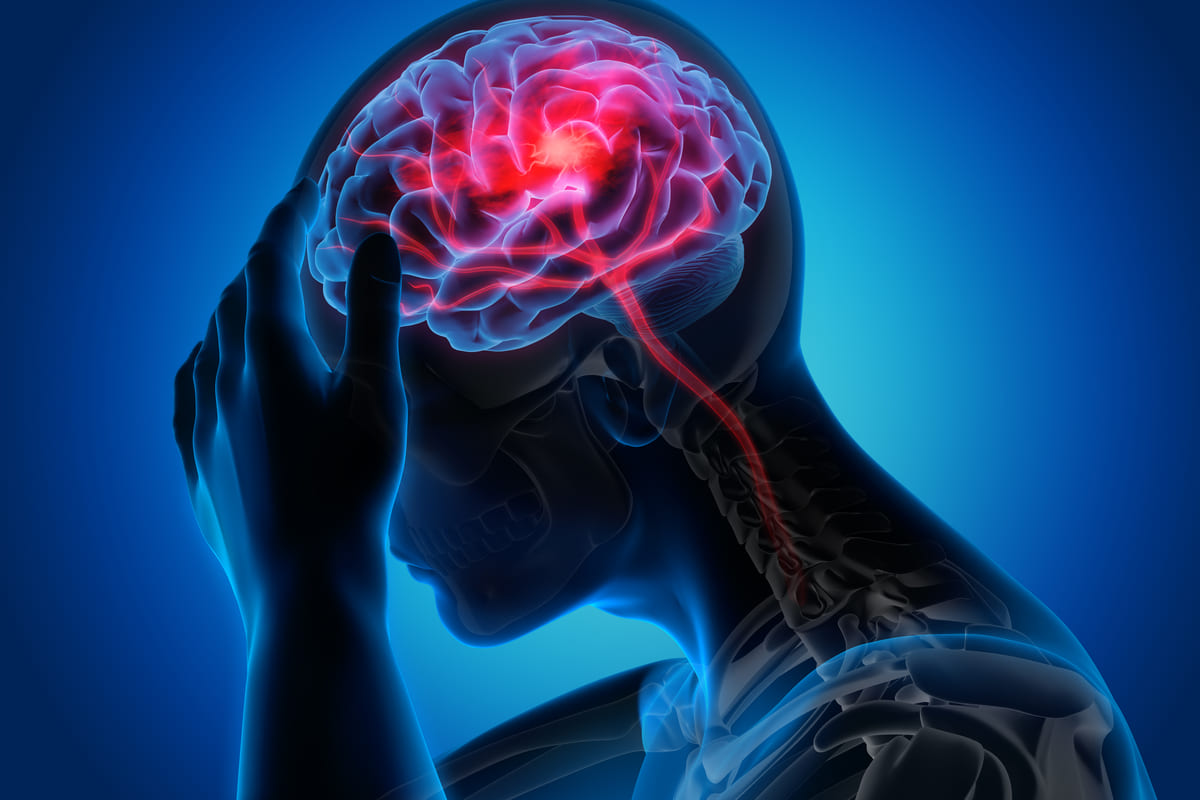 đau trên đỉnh đầu đau trên đỉnh đầu