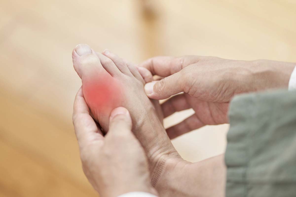 Người bệnh gout nên ăn gì và kiêng gì để kiểm soát bệnh? 35 bệnh gout nên ăn gì và cần lưu ý gì