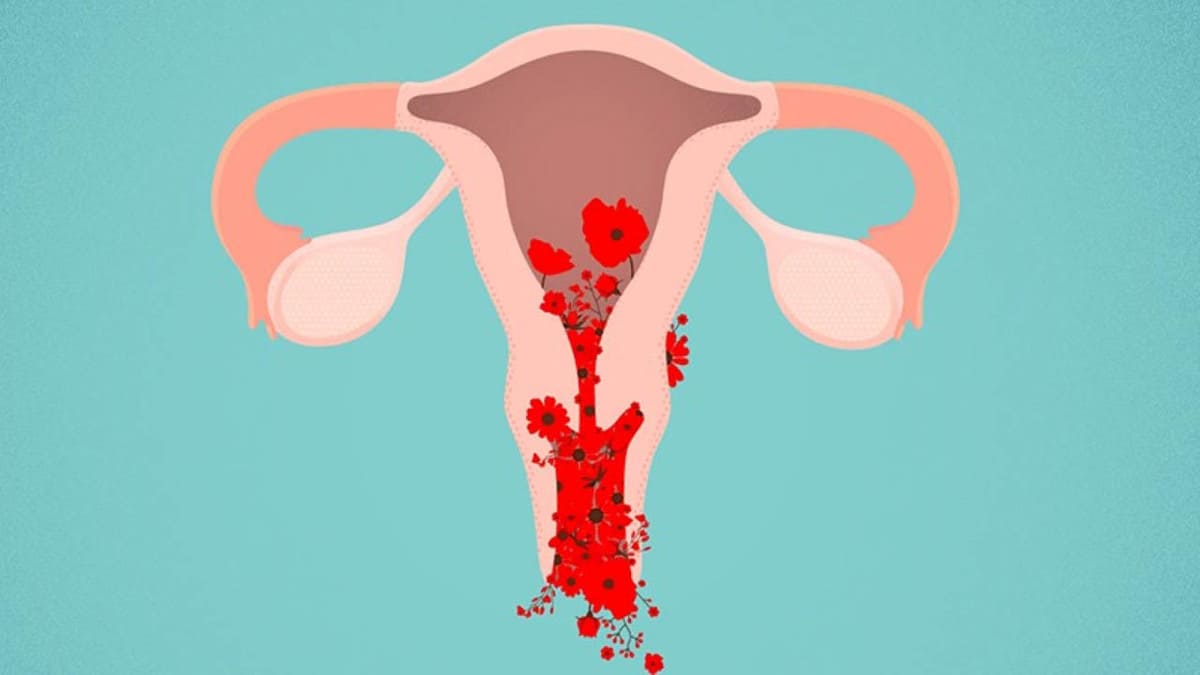 Cách điều trị rong kinh tiền mãn kinh hiệu quả 36 tình trạng rong kinh tiền mãn kinh