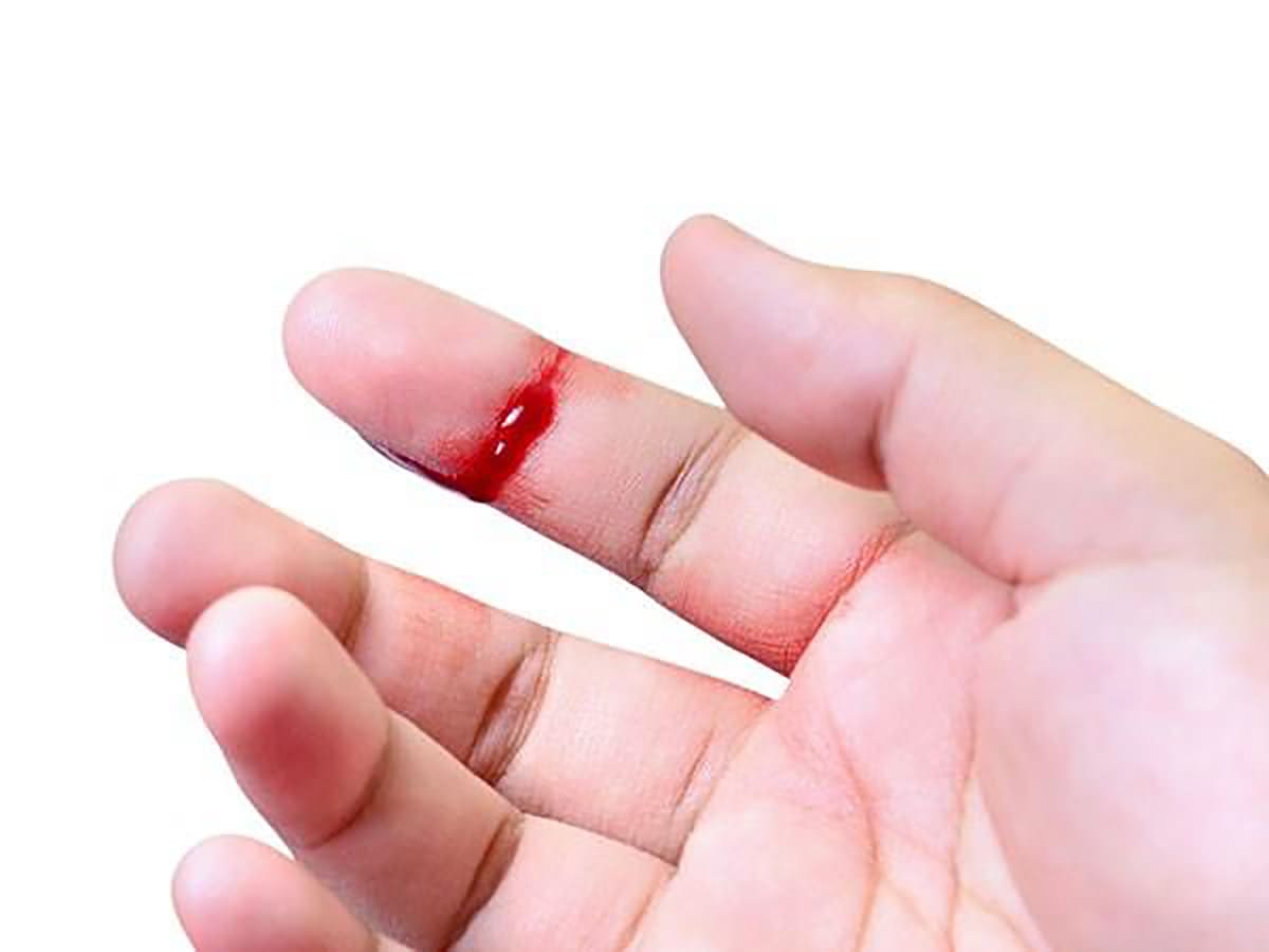 thiếu vitamin K thiếu vitamin K