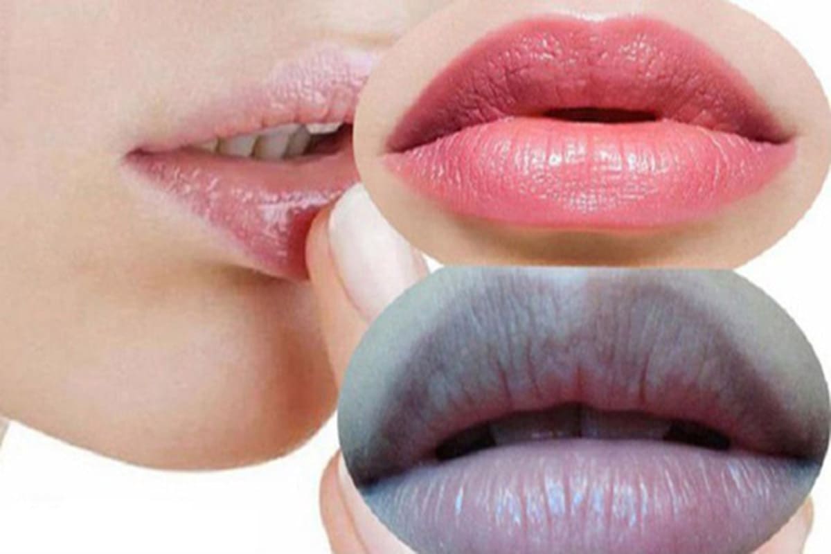 4 cách trị thâm môi bằng mật ong cho đôi môi hồng hào, căng mịn 36 môi thâm
