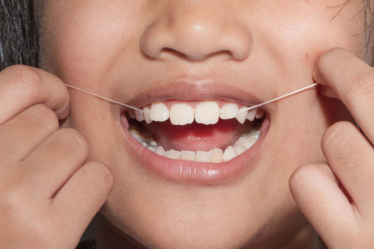 chăm sóc răng miệng cách dùng chỉ nha khoa cần lưu ý gì