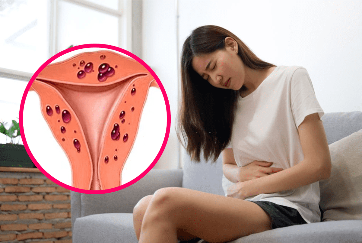 tử cung lạc nội mạc tử cung