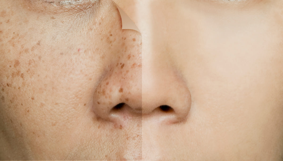 Niacinamide là gì, công dụng dưỡng da có "thần thánh" như lời đồn? 37 Công dụng của Niacinamide là gì