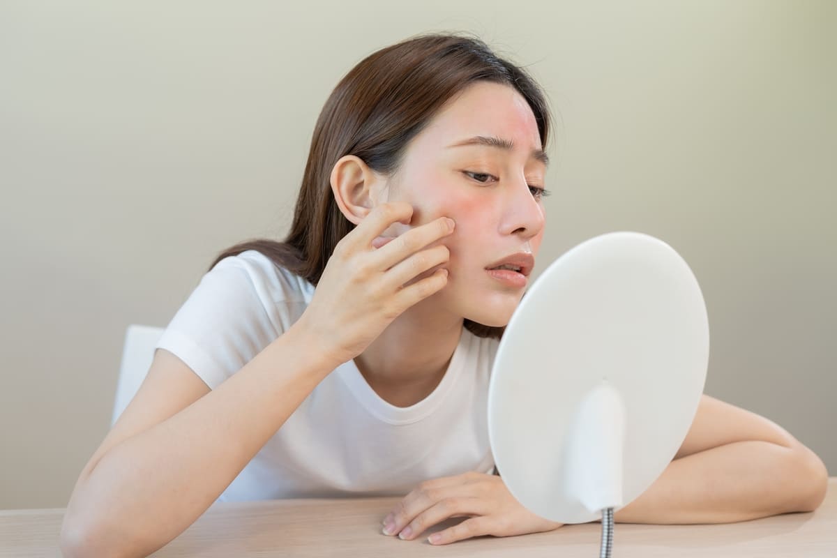 Nguyên nhân dị ứng đậu phộng