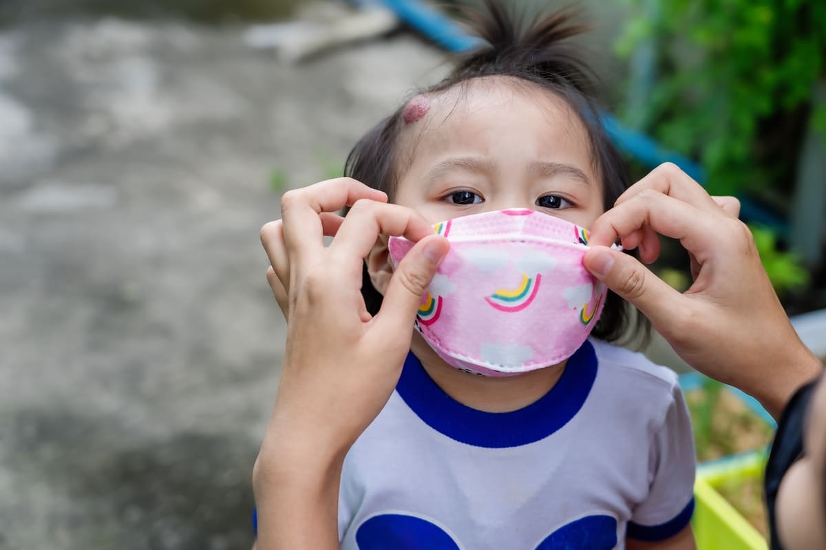 Cách điều trị u máu ở trẻ em