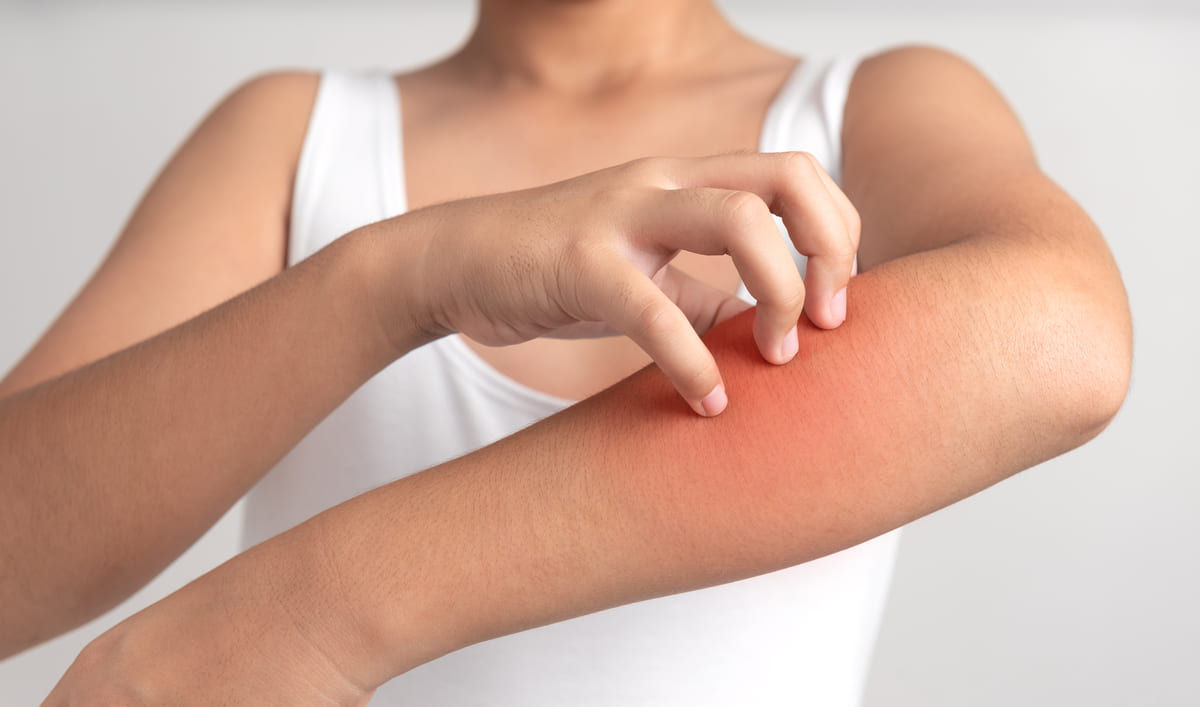 tình trạng da bị mẩn ngứa sau khi tắm tình trạng da mẩn ngứa sau khi tắm
