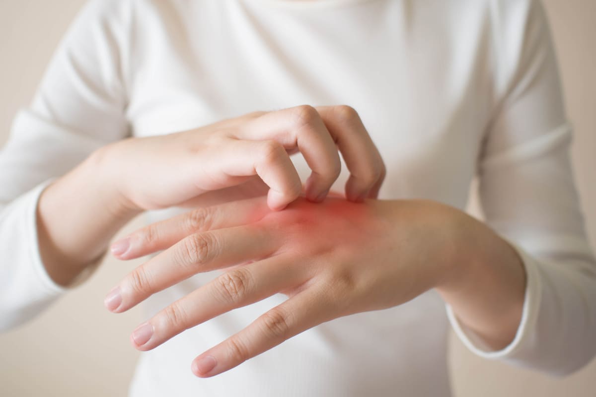 da bị mẩn ngứa sau khi tắm nguyên nhân da mẩn ngứa sau khi tắm