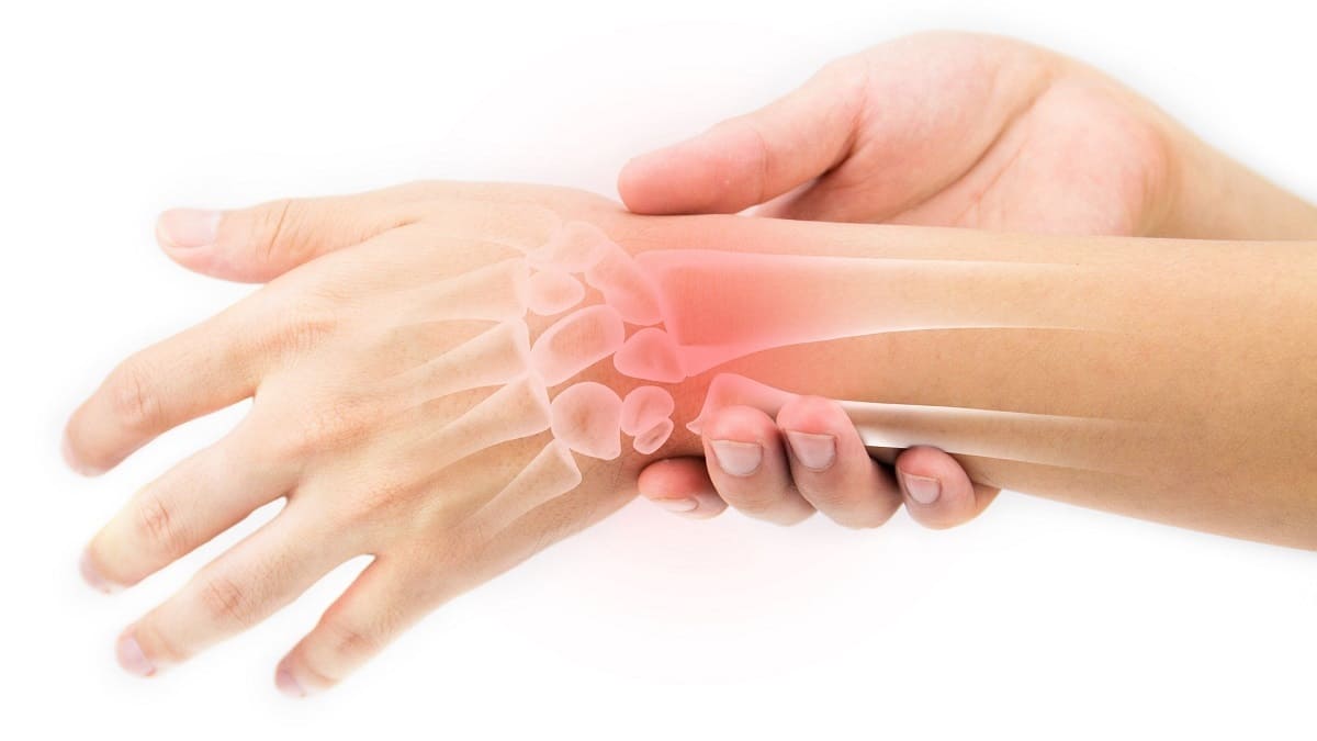 Nguyên nhân gây ra hội chứng ống cổ tay