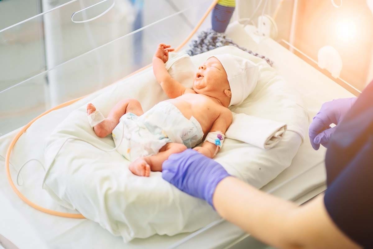 sinh non biến chứng dài hạn của sinh non
