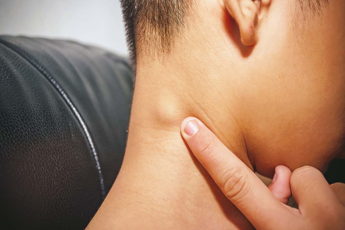 Nổi hạch sau tai ở trẻ nhỏ là dấu hiệu của một số bệnh lý Nổi hạch sau tai ở trẻ nhỏ cảnh báo một số bệnh lý