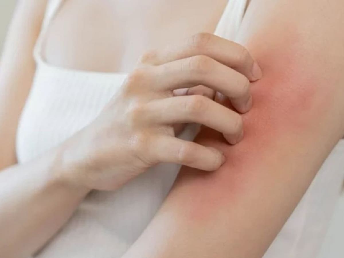 nguyên nhân gây ngứa da và cách chăm sóc da nguyên nhân gây ngứa da và cách điều trị