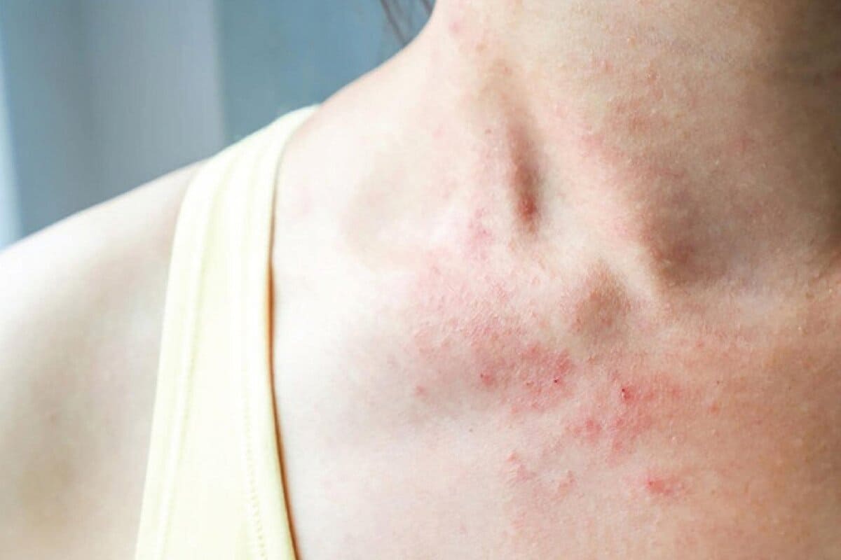 nguyên nhân bị ngứa da ngứa da có sao không