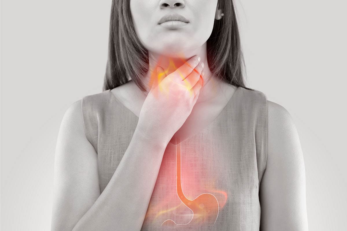 nóng rát cổ họng do Trào ngược axit dạ dà Trào ngược axit dạ dày là nguyên nhân gây nóng rát cổ họng