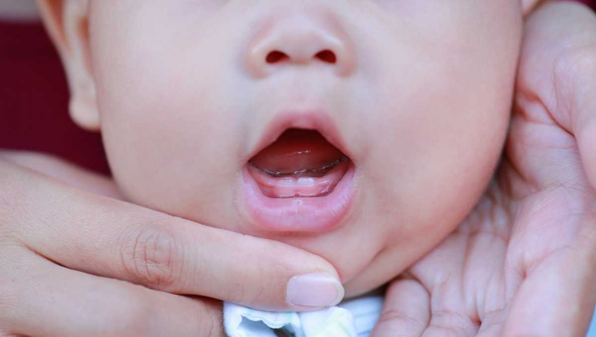 giai đoạn trẻ sơ sinh mọc răng Thời điểm trẻ sơ sinh mọc răng