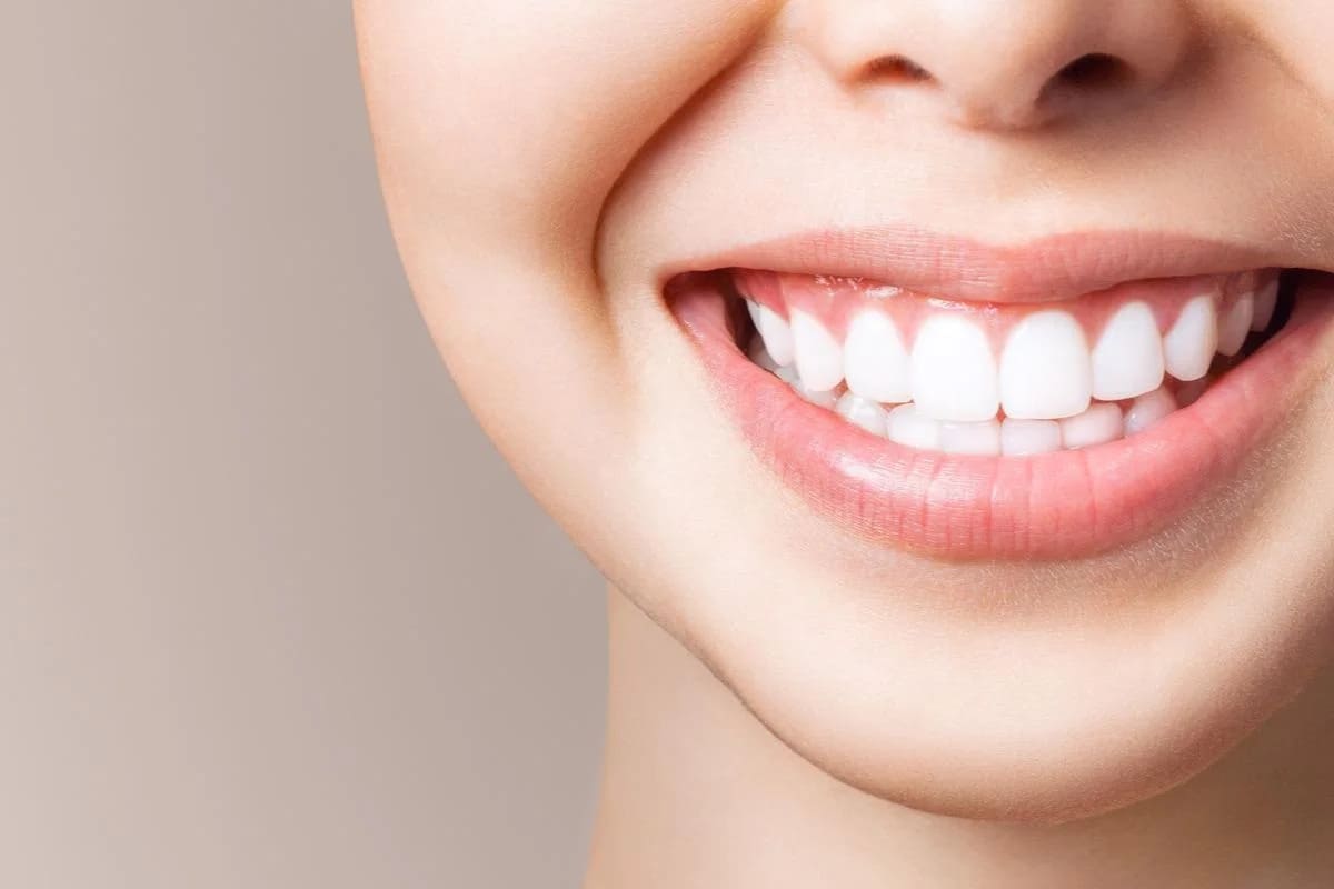Cách làm trắng răng tự nhiên