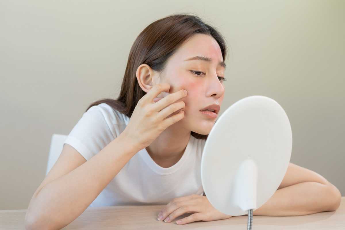 đối tượng dễ mắc da mặt bị khô đối tượng da mặt bị khô