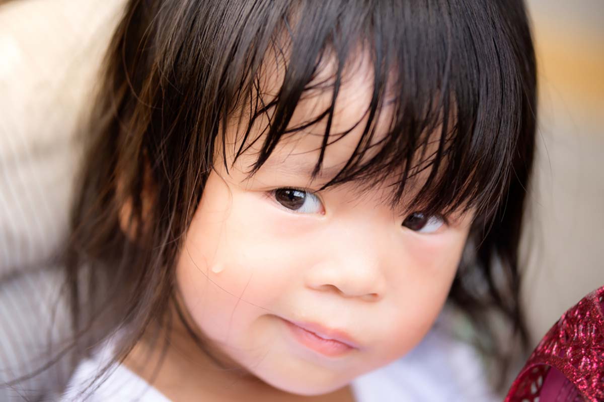 Trẻ đổ mồ hôi nhiều có đáng lo không?