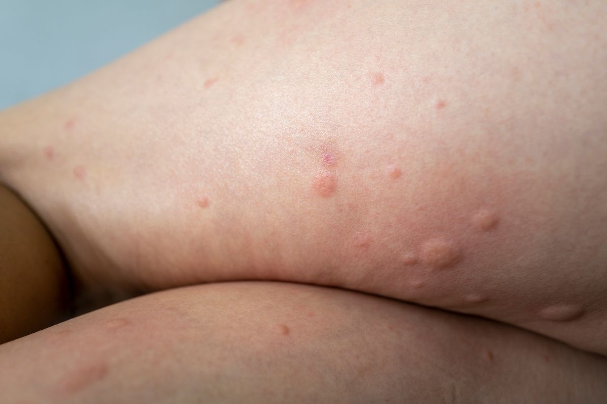 3 cách kiểm soát ảnh hưởng của lông chó mèo với trẻ sơ sinh, 