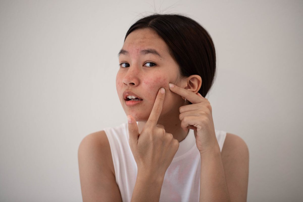Rối loạn kinh nguyệt? 