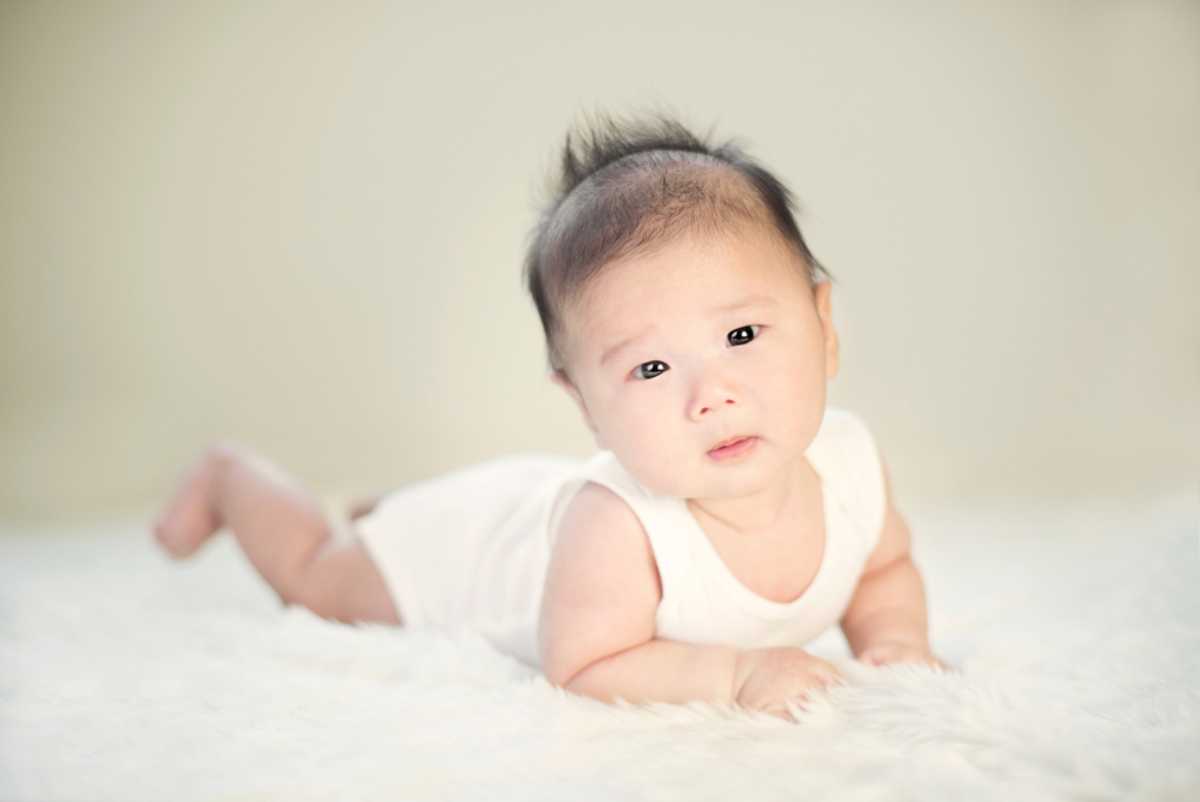 vẹo cổ ở trẻ sơ sinh do nhiều nguyên nhân 