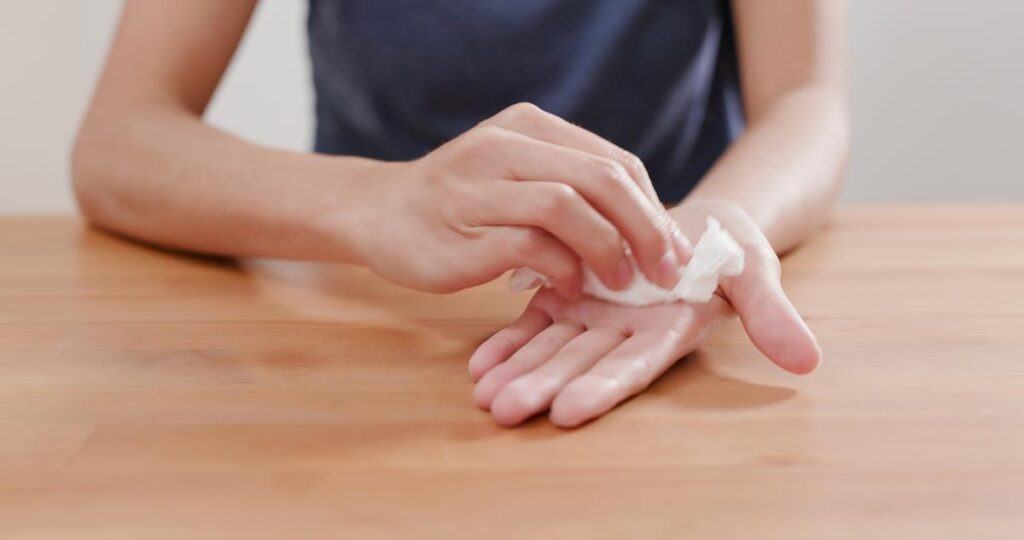 Ra mồ hôi tay nhiều có sao không