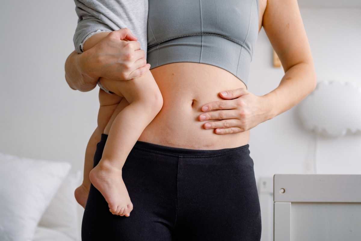 Sinh mổ lần 3 cần chuẩn bị gì để mẹ tròn con vuông