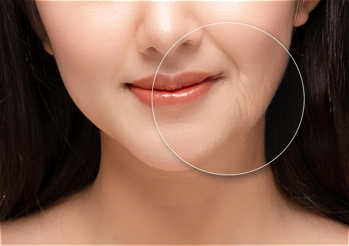 các biện pháp chống lão hóa da những biện pháp chống lão hóa da